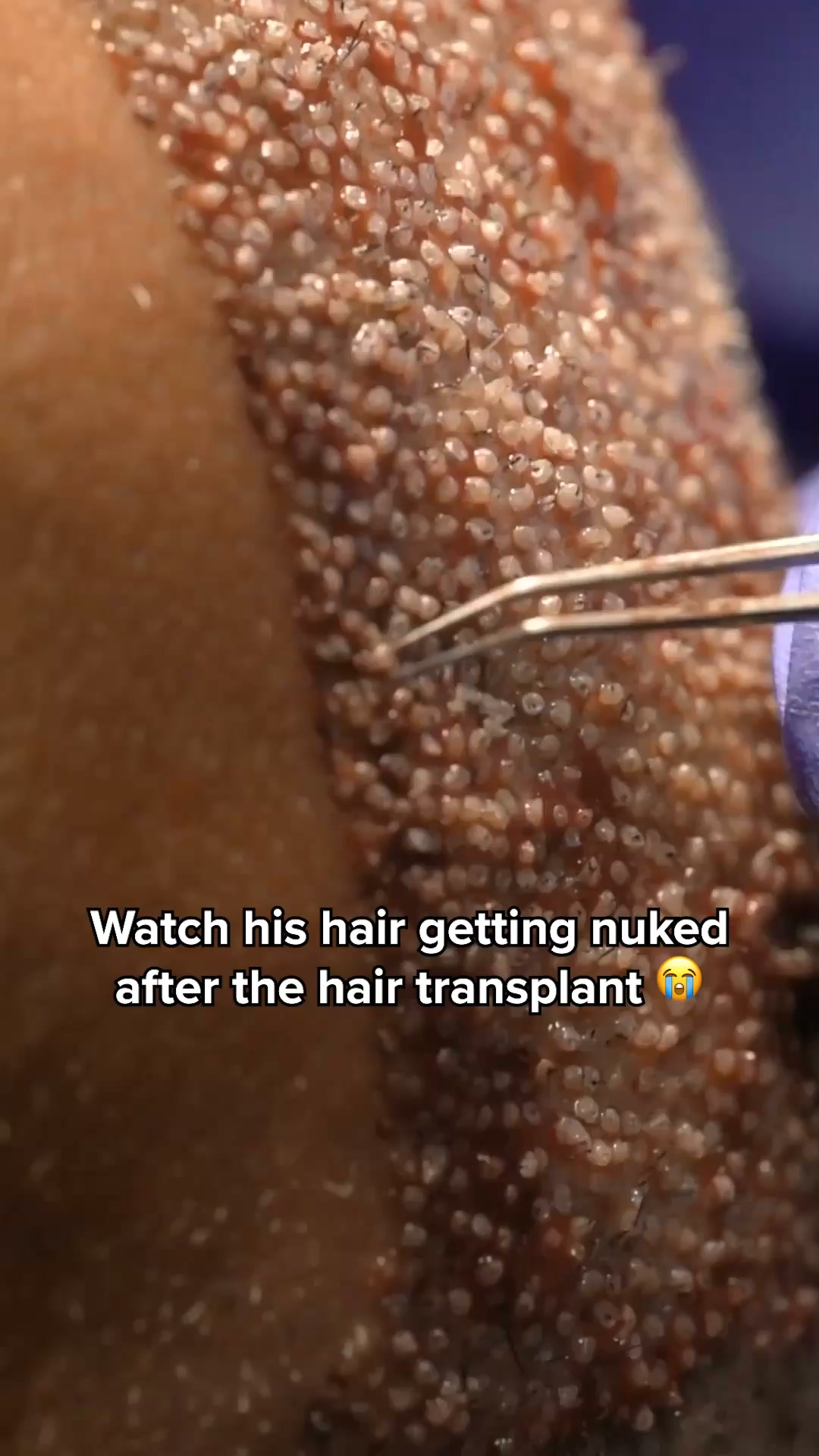 Restore your hair!
