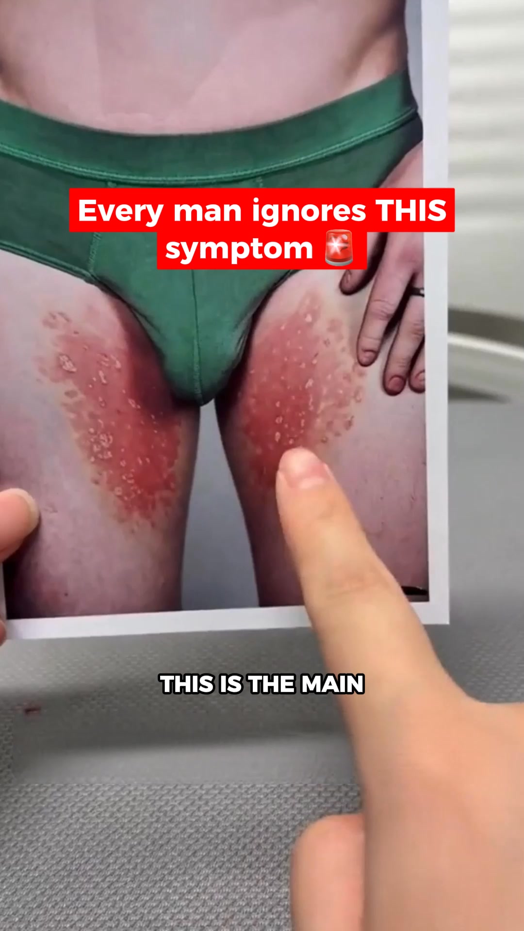 Why Your Jock Itch Keeps Coming Back