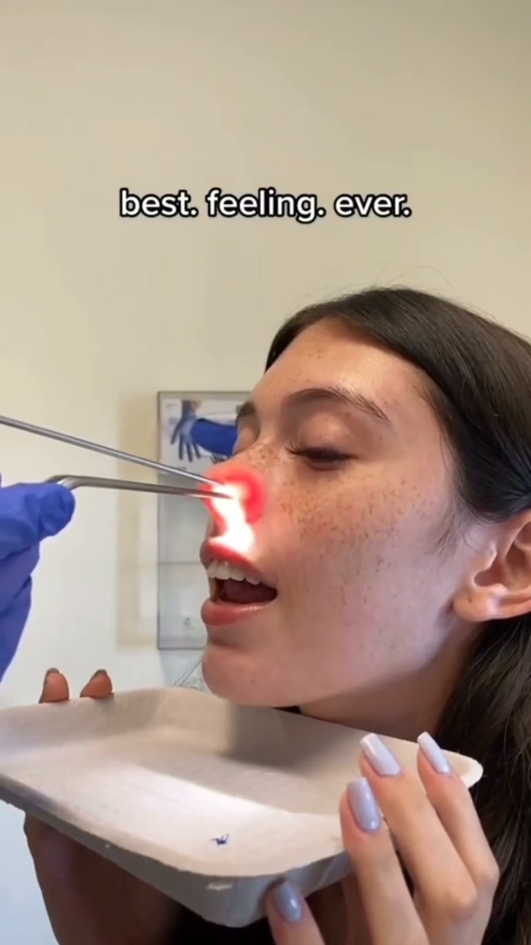 Sprays & Surgery Failed? Your Nighttime Congestion Ends Here