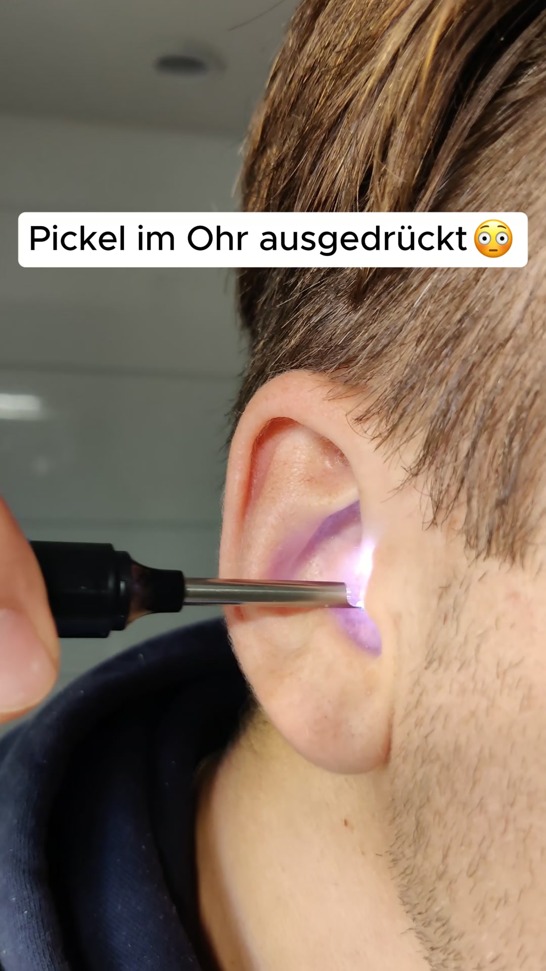 Nie wieder blind im Ohr herumstochern