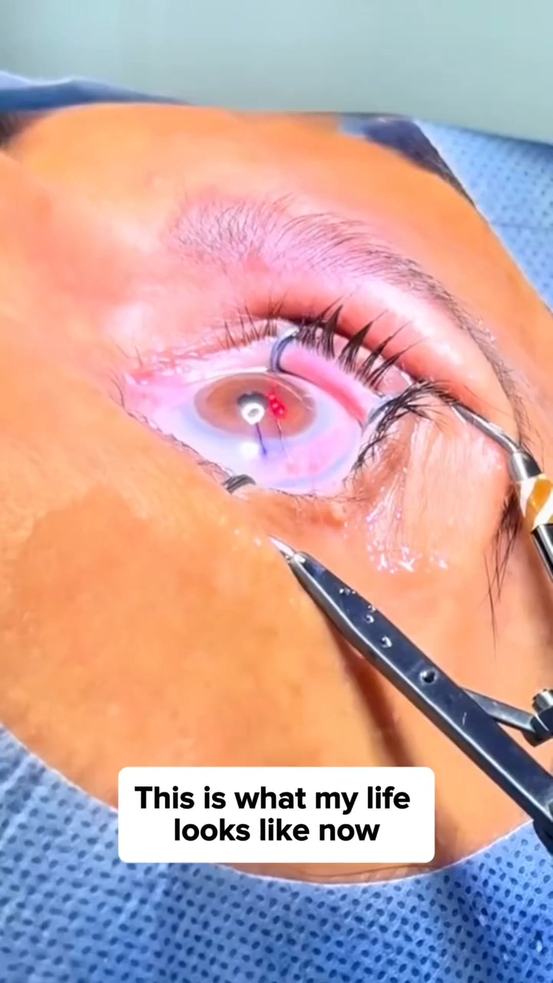 Fight Back Against Macular Degeneration!