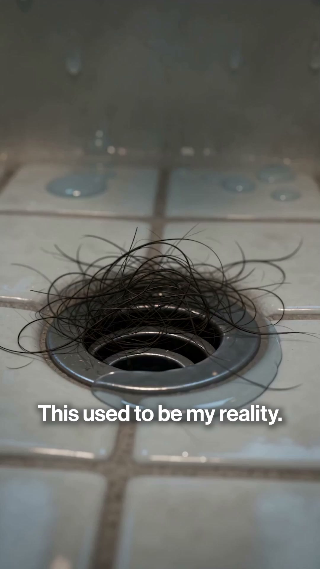 Hair thinning at the crown or temples?