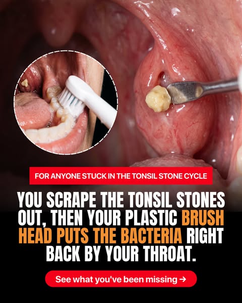 The brush head design dental hygiene research favors