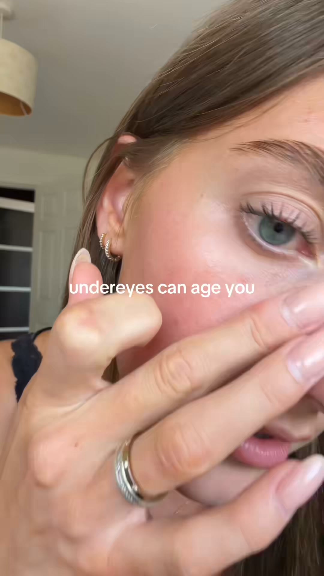 If Your Dark Circles Never Fully Go Away No Matter What You Try — Read This.