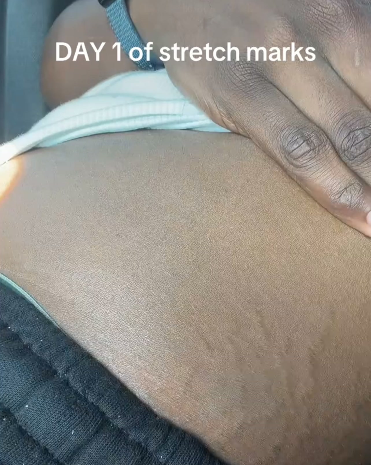 Smoother Skin in 4 Weeks