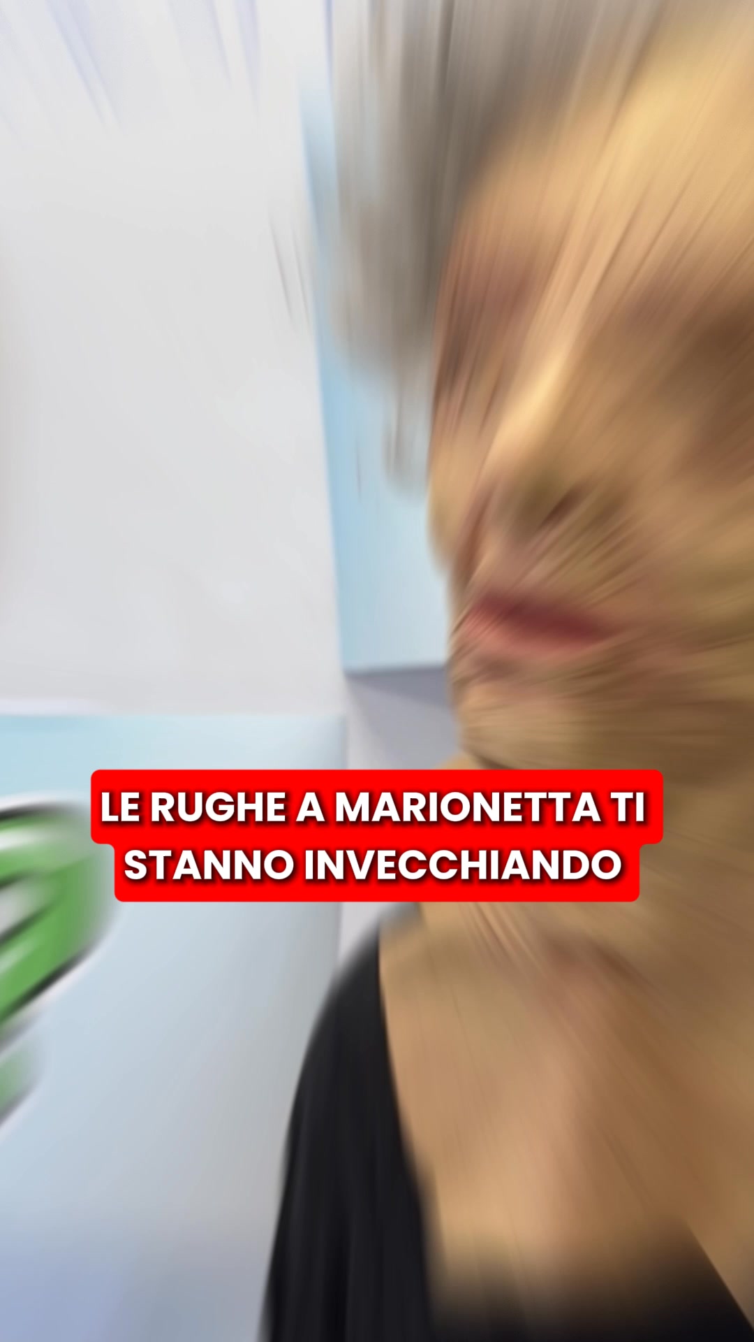 Scopri la micro-infusione Renovae