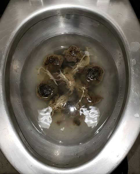 my bloat is gone