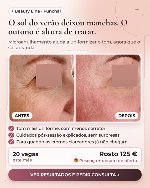 Vê os resultados reais no site