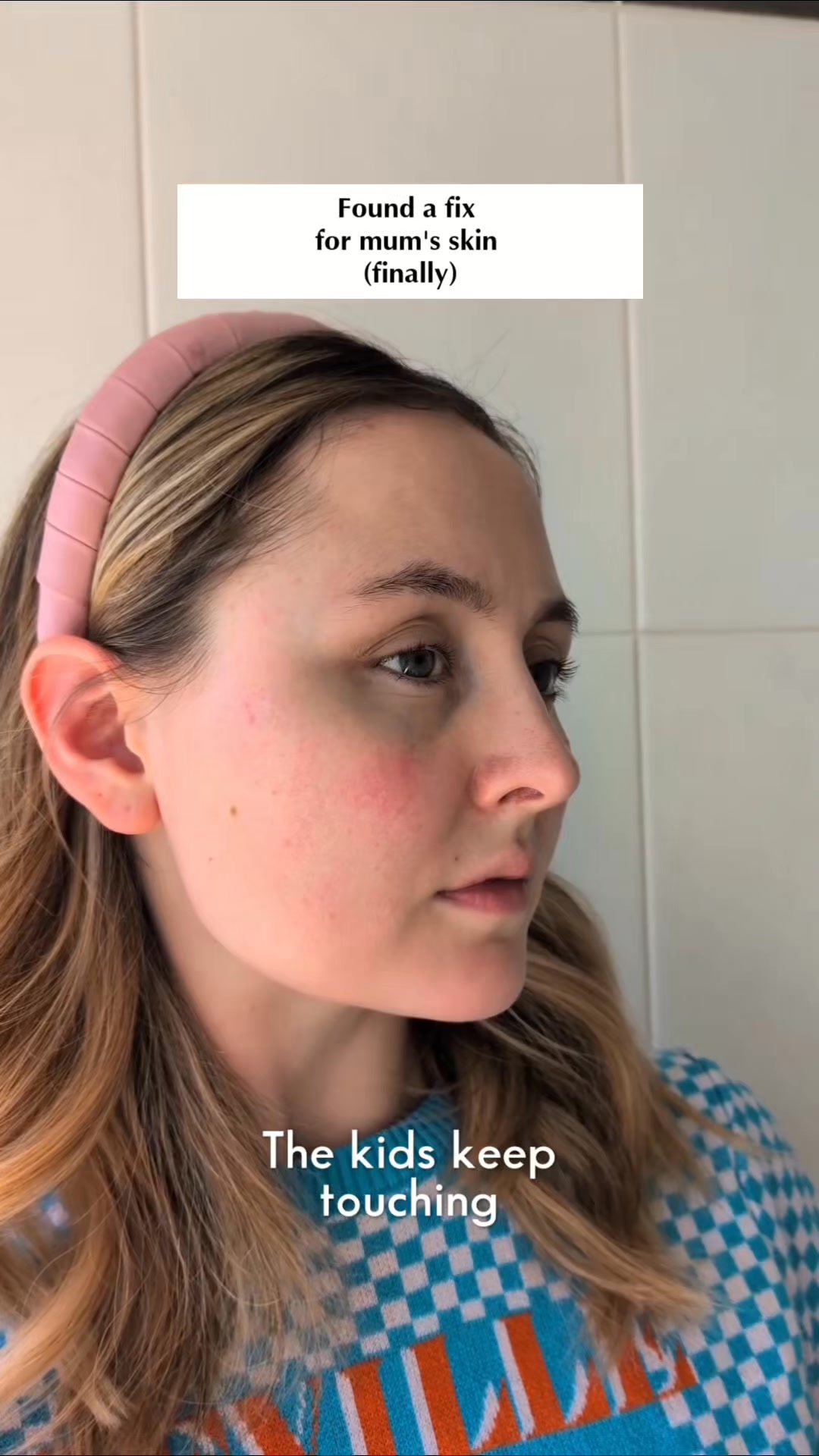 Your skin isn't the problem. Your moisturiser is.
