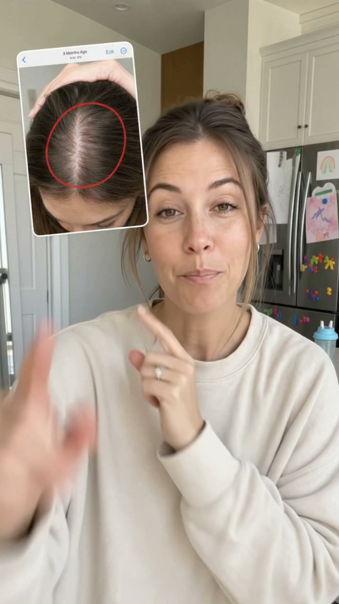 The Missing First Step for Thinning Hair.