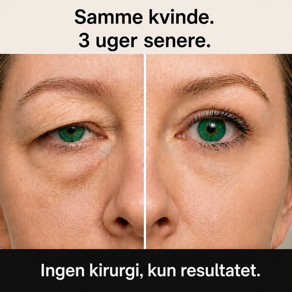 Læs dette, hvis du har hængende øjenlåg.