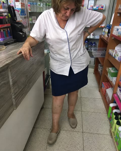 Piernas hinchadas al final del día?