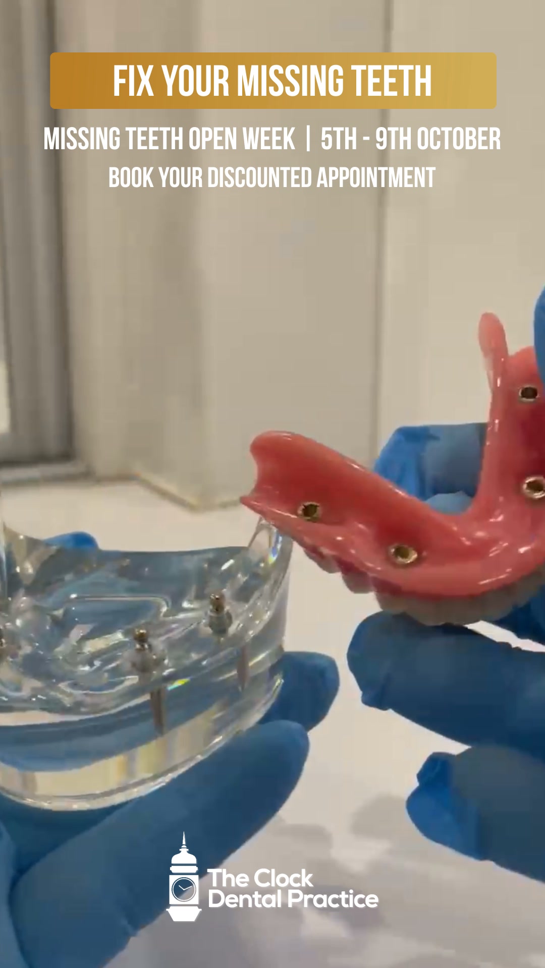 Discounts on Implants, Dentures, Crowns