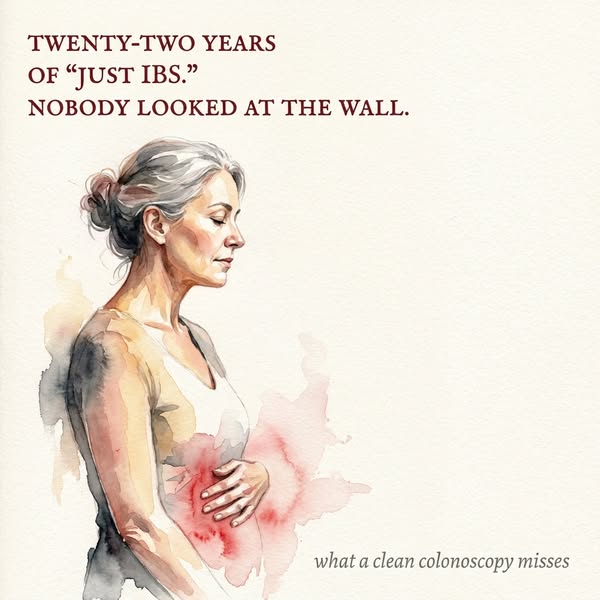 Twenty-Two Years Of "Just IBS." Nobody Ever Looked At The Wall.