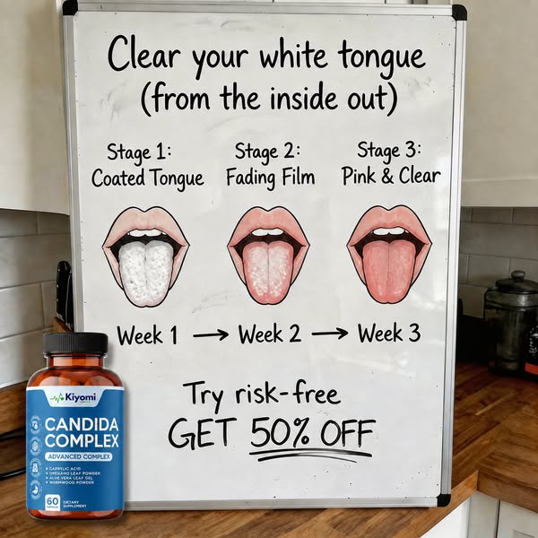 White Tongue Keeps Coming Back?