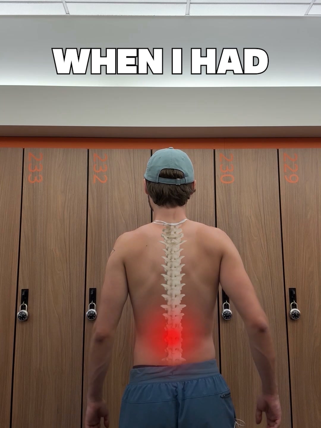 Back pain and the muscle doctors rarely mention