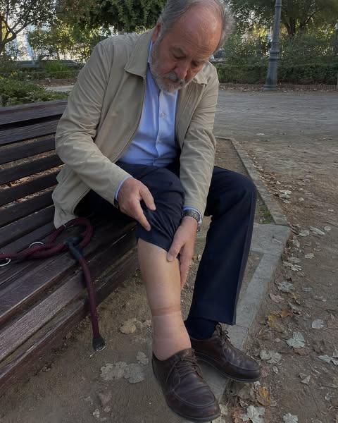 La hinchazón en las piernas...