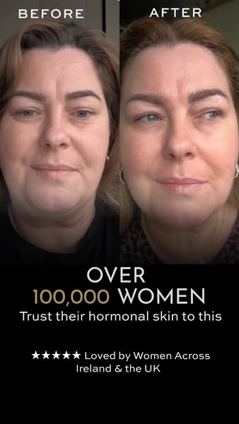Irish Skincare Trial [Risk-Free]