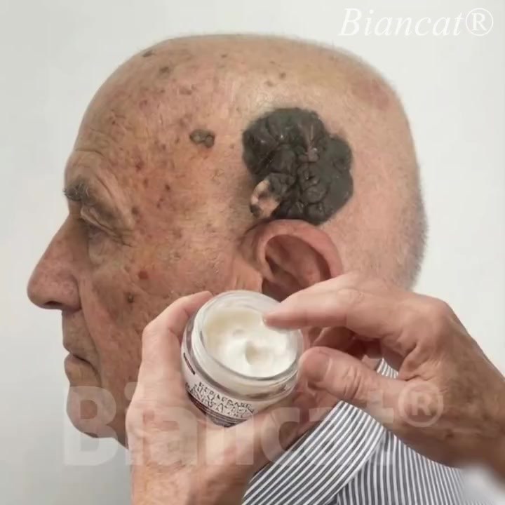 Anúncio de Dr. James Hartfield
