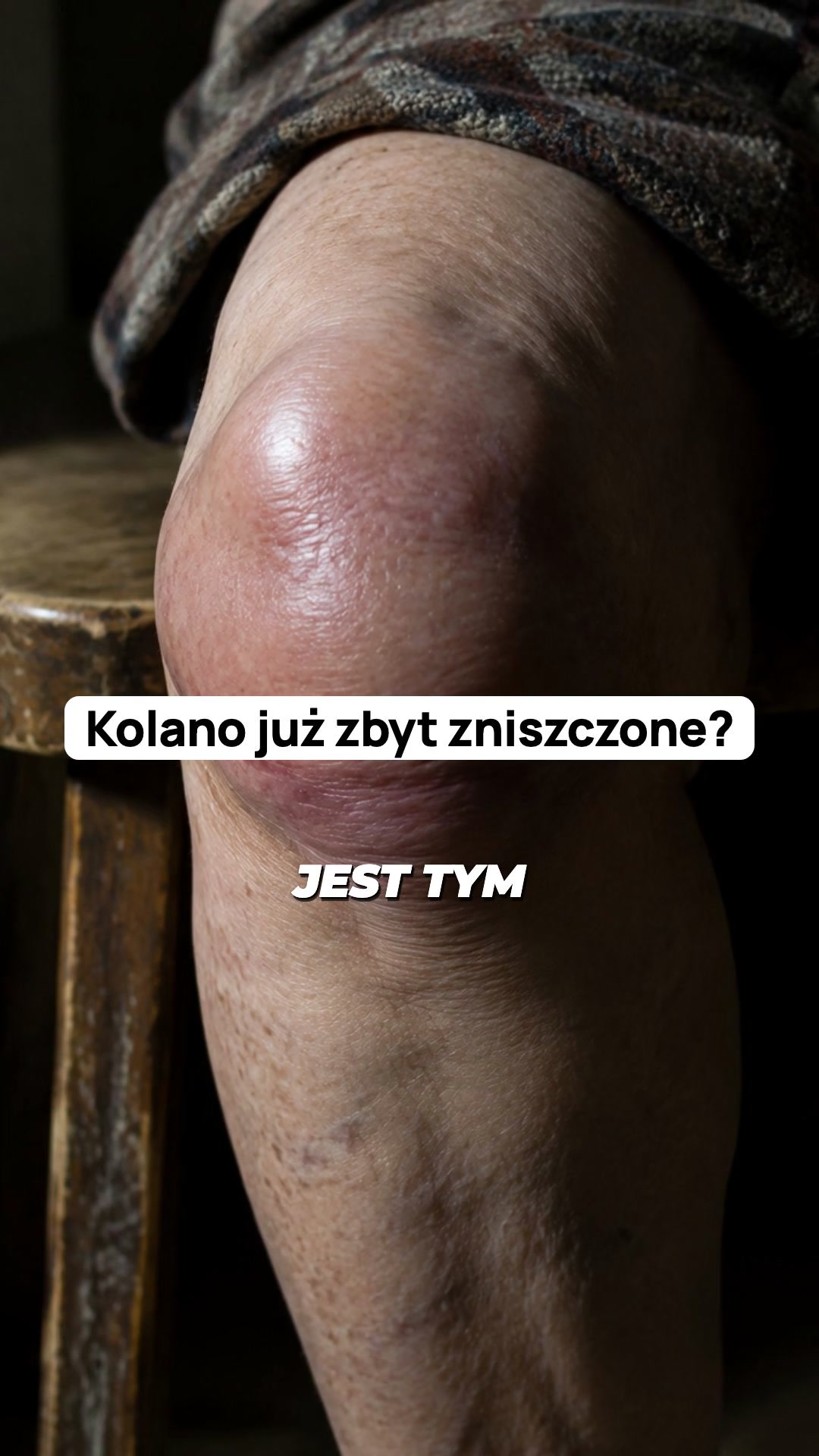 Ból kolan przy wchodzeniu po schodach?