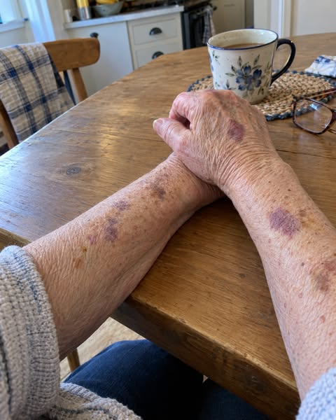 The dermatologist was totally wrong about my arms