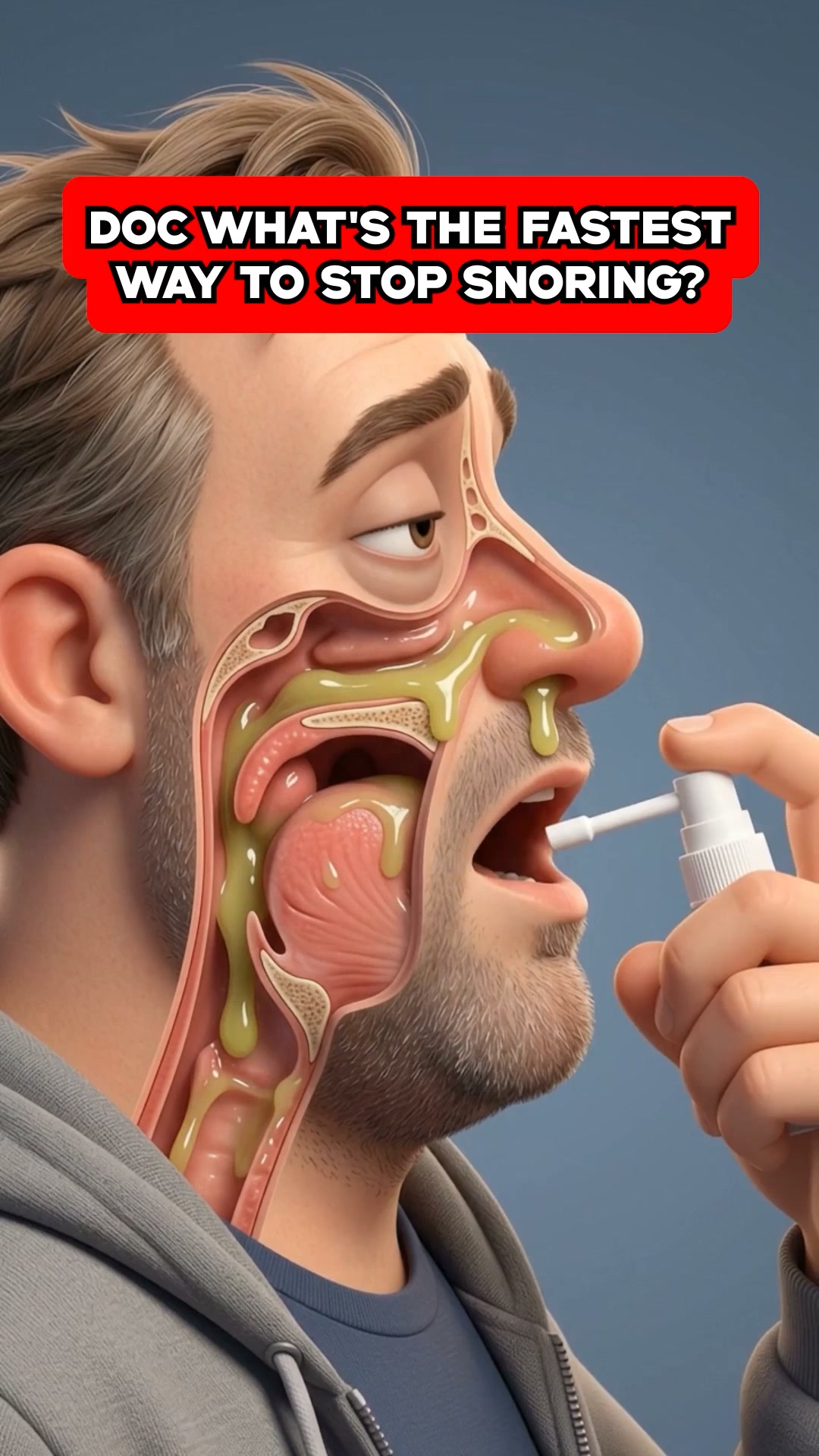 No More Snoring