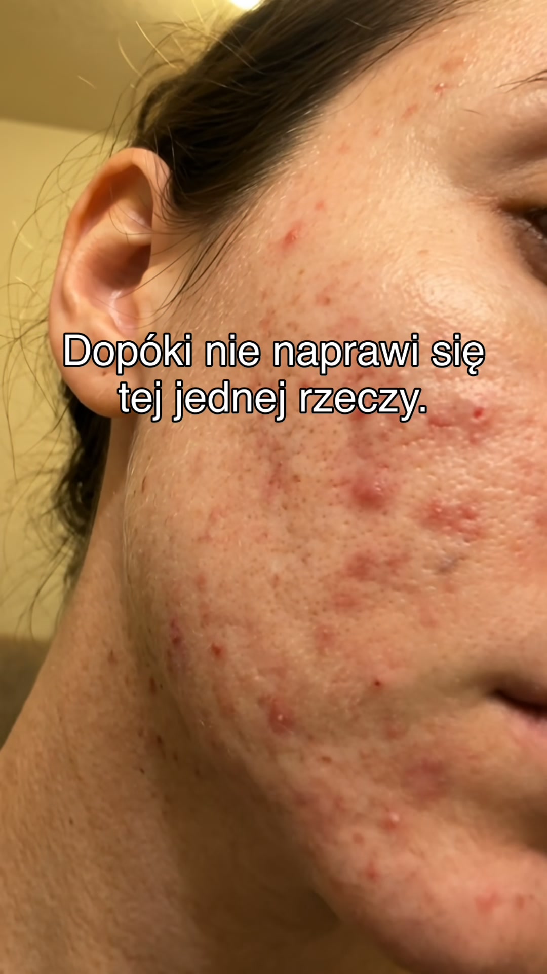 Co w jelitach, to na skórze.