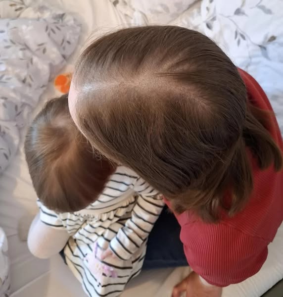 My daughter lined up four photos of me. That's when I saw how bad it really was.