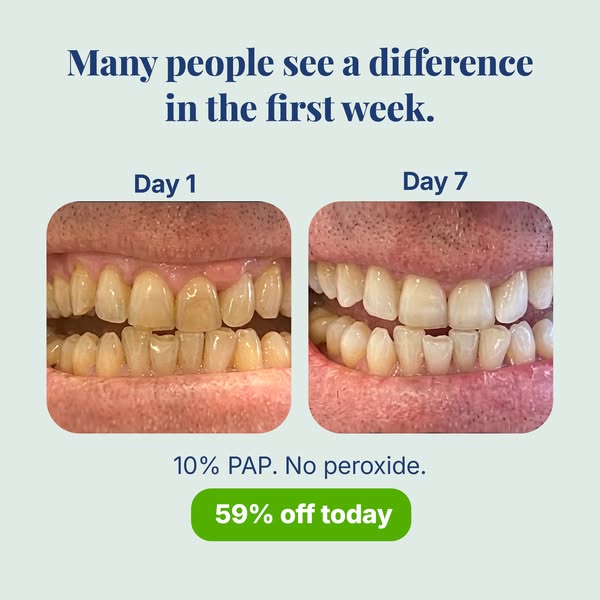 59% OFF