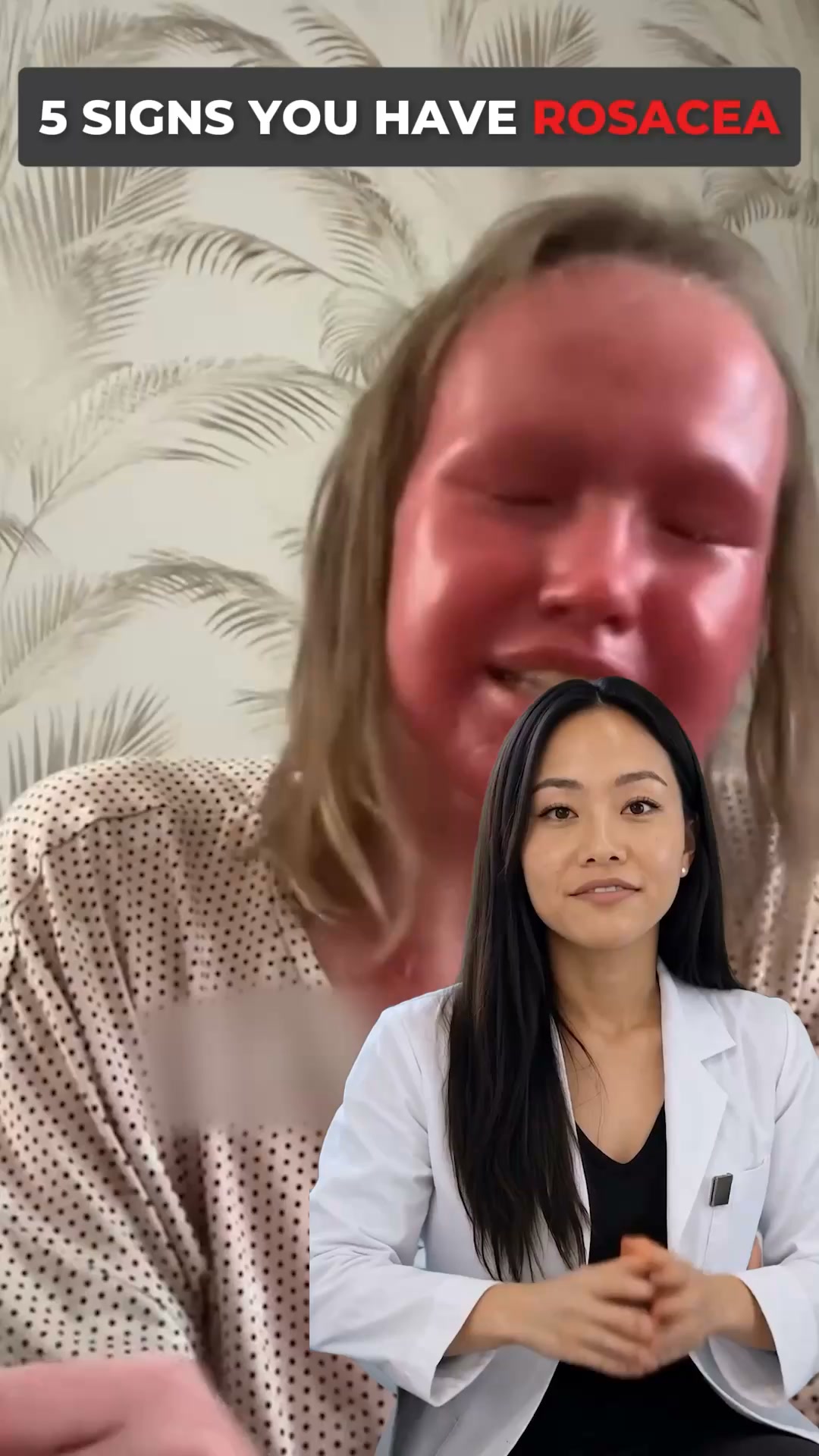 The Rosacea Myth: The Real Reason Flare-Ups Keep Coming Back