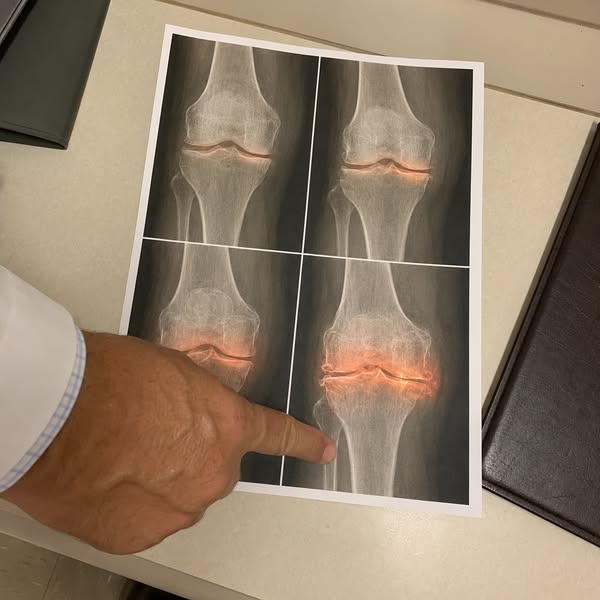 "12 years of knee pain gone in 2 days?"