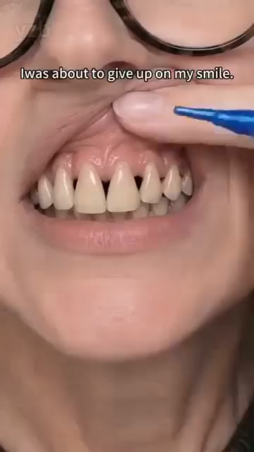 Anúncio de Stokrot