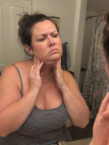 I thought I had a weight problem. It turned out my face was just constantly puffy.
