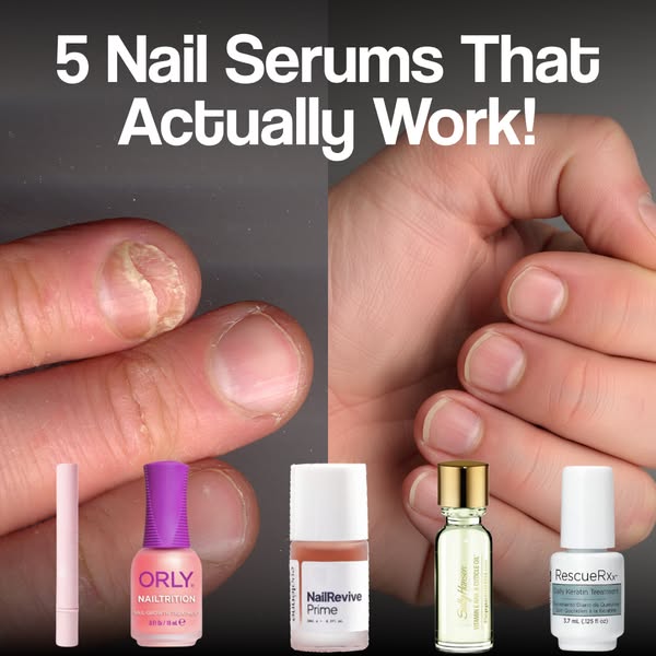 5 Nail Serums That'll Give Results Within 3 Weeks!
