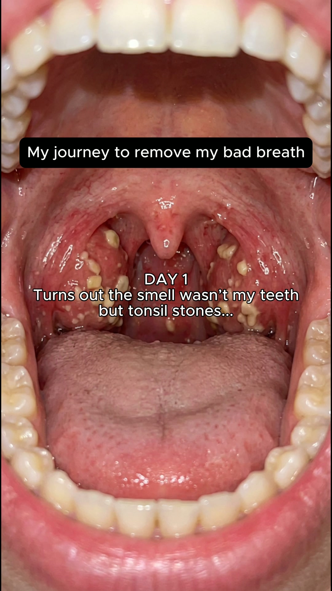 Why your breath never feels fresh