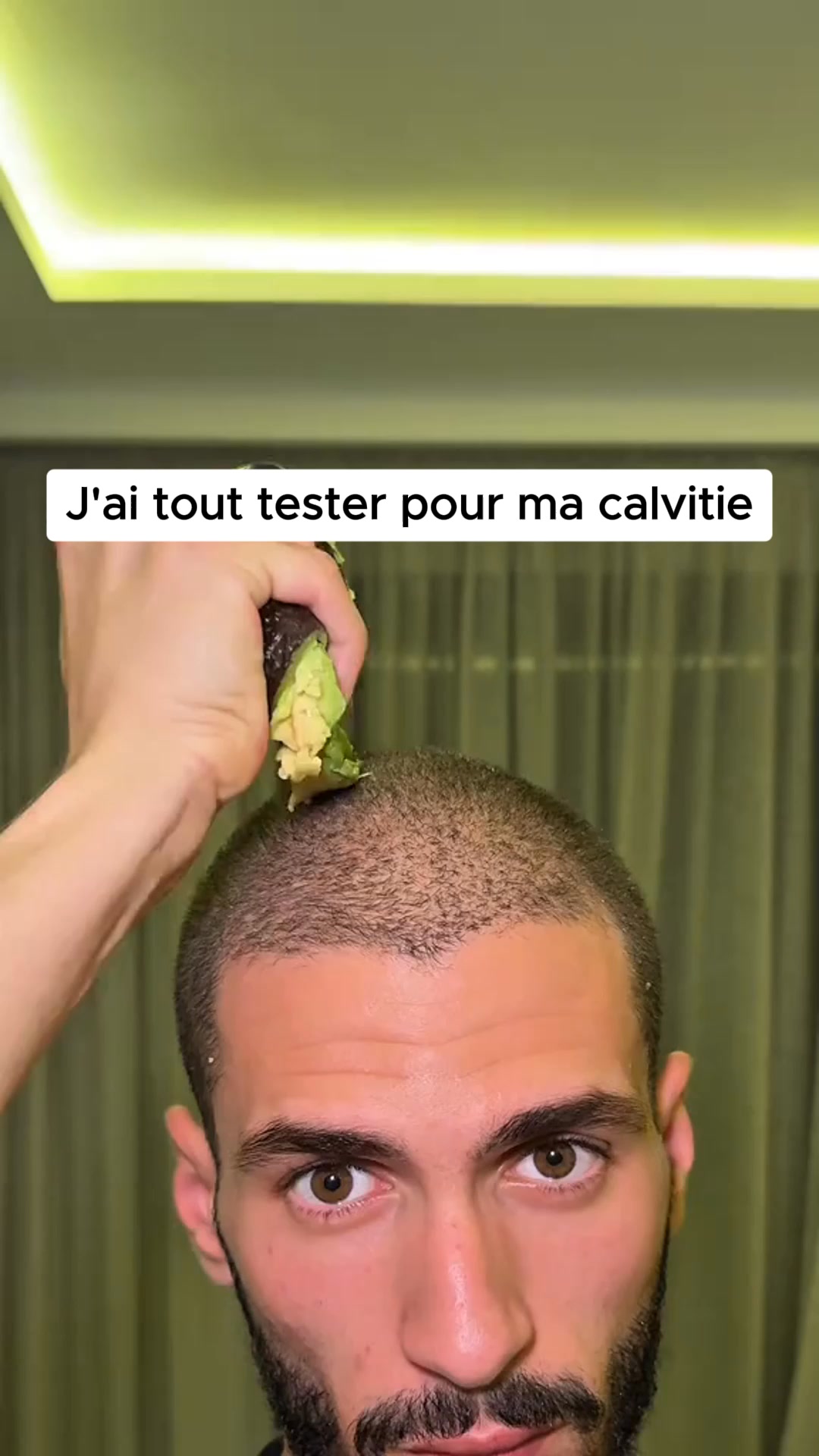 Complexe capillaire ? La solution en 30s