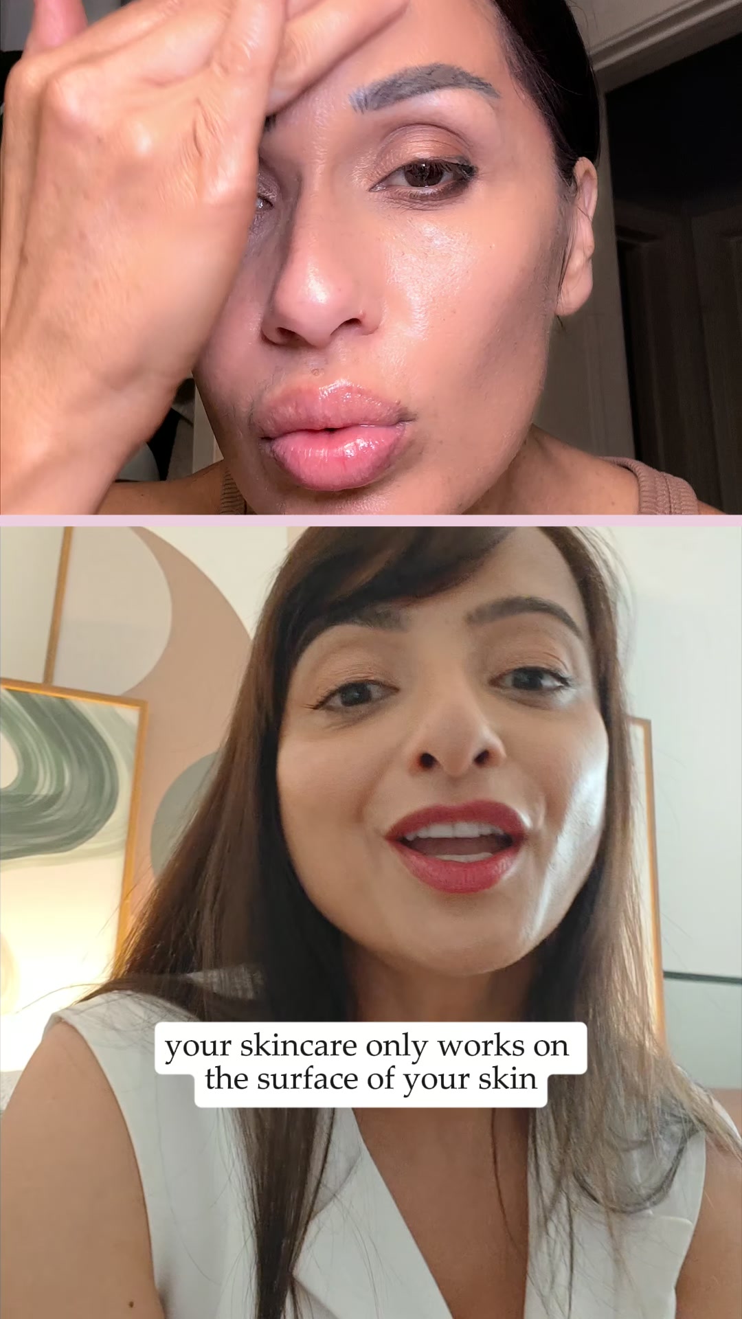 Clearer Skin in 12 Weeks