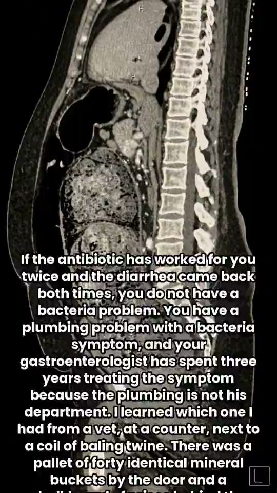 Read if rifaximin didn’t work