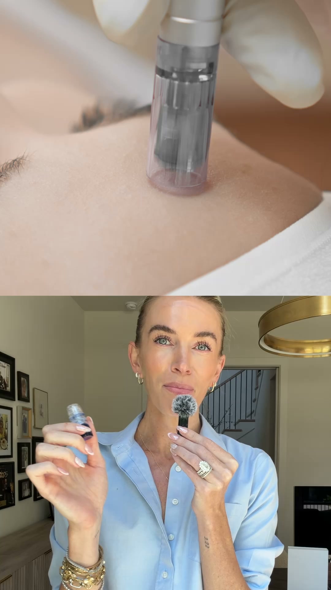 Three things I check before recommending any micro-infusion device