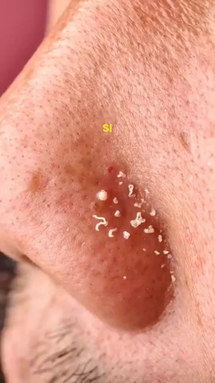 Un Nez Propre Et Lisse A La Maison