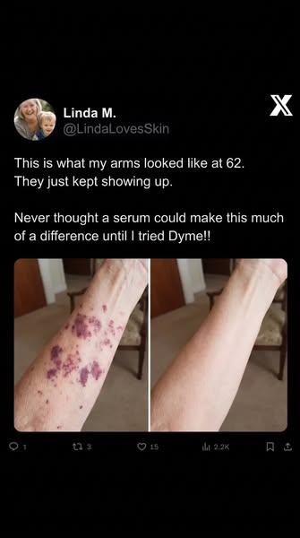 You shouldn't have to explain your arms