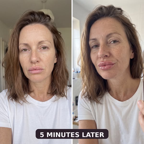 My Lips Came Back to Life!