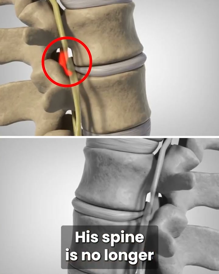 Say Goodbye to Back Pain!