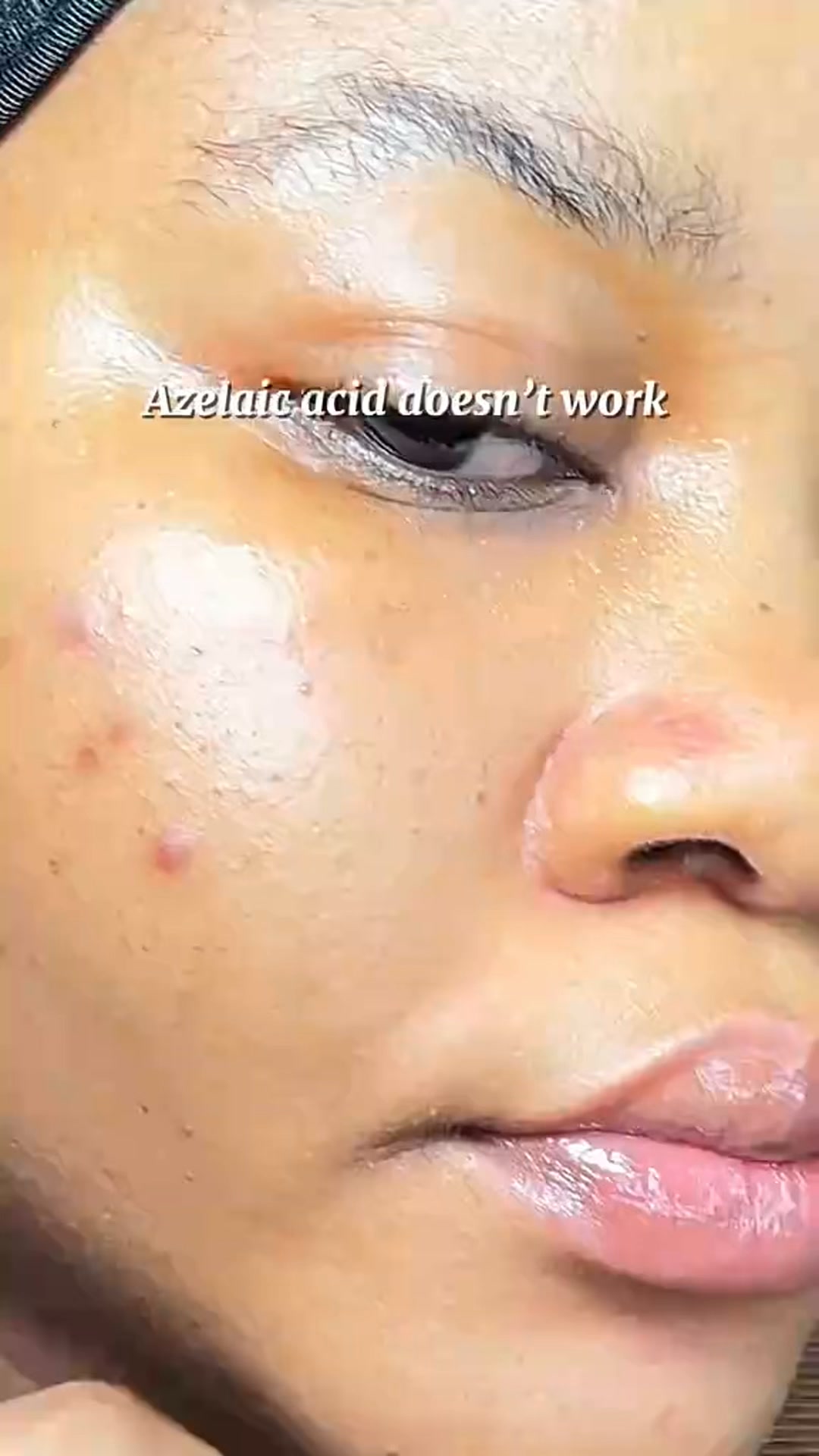 Calmer, Clearer-Looking Skin