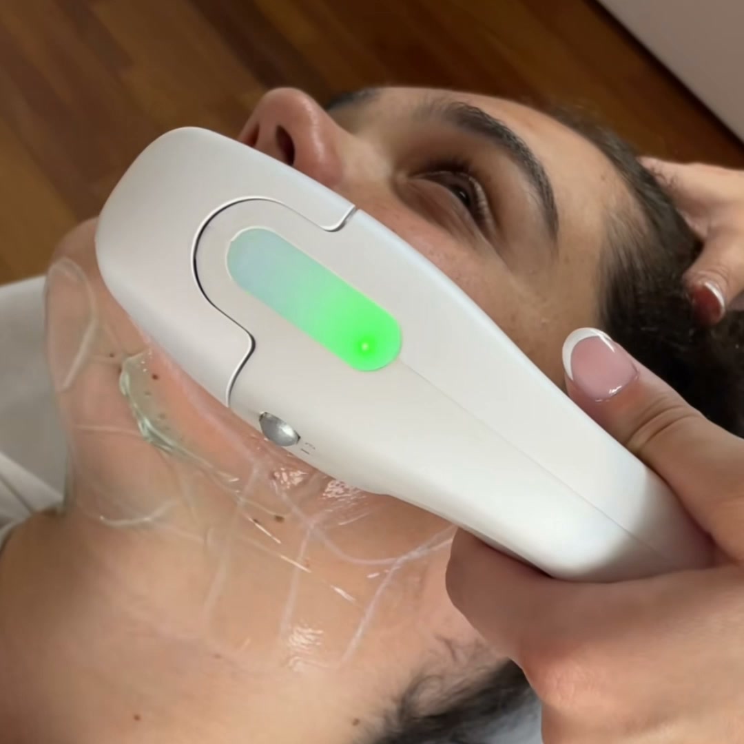Aprende HIFU 360° Desde Cero