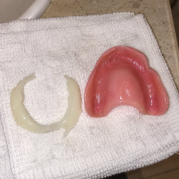 Read this if you wear dentures