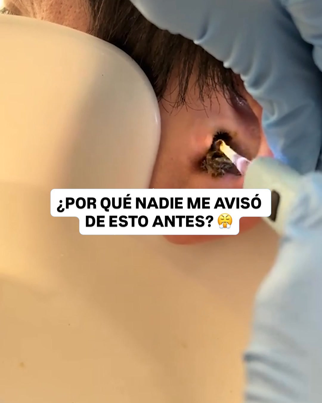 CONTRAREEMBOLSO