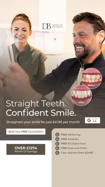 Clear aligners. Big smile energy