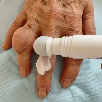 Σχεδιασμένο για εξαιρετικά στοχευμένη φροντίδα των αρθρώσεων, με ειδική ακρίβεια για τα χέρια και τις μικρότερες αρθρώσεις