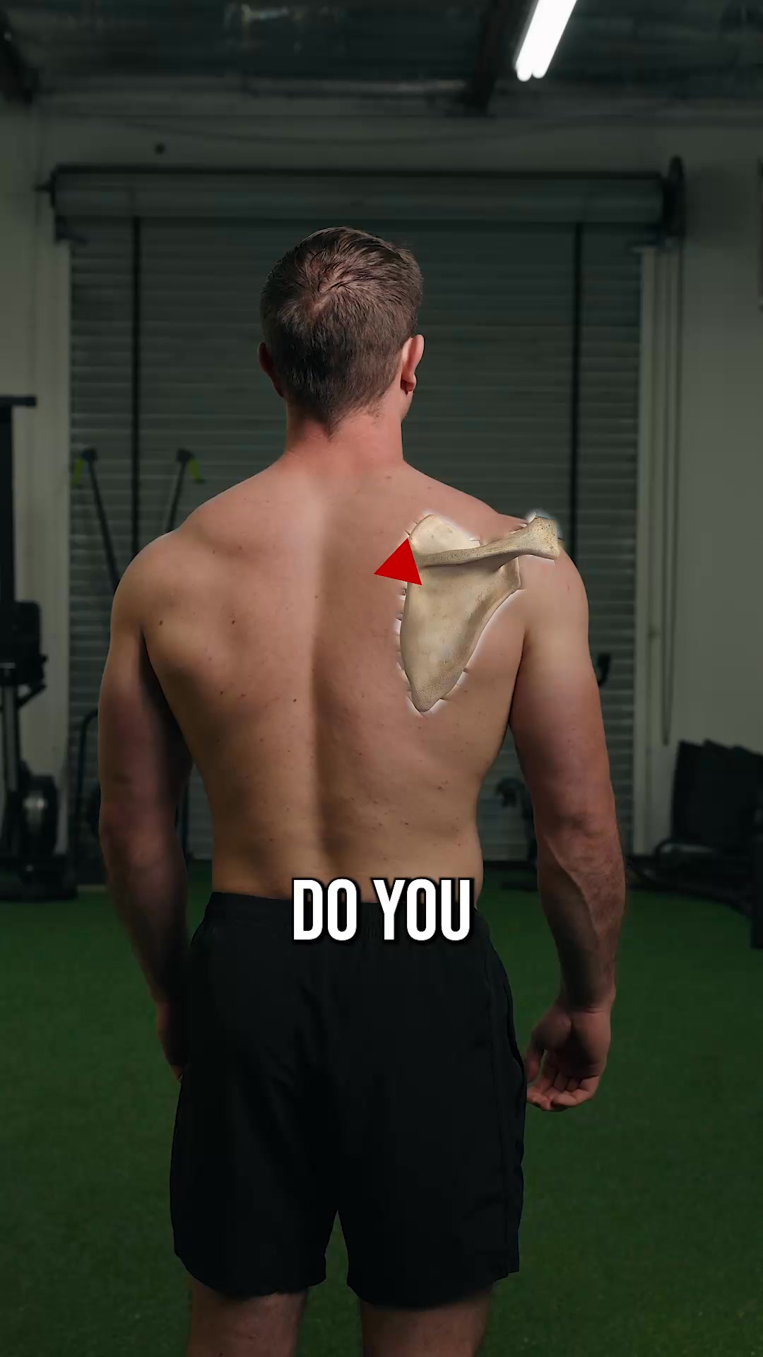 Scapular Winging? You’re Missing This Muscle